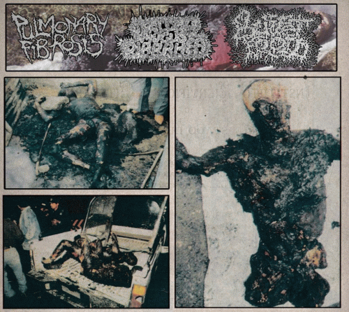 Swallow Mucus Diarrhea : Pulmonary Fibrosis - Swallow Mucus Diarrhea - Buffet Froid